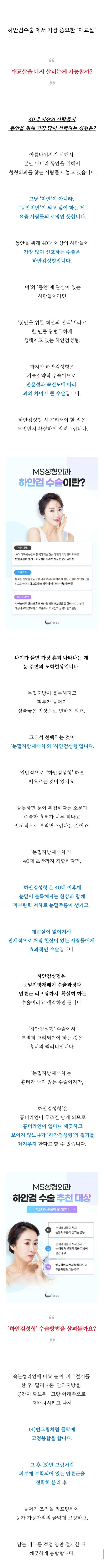 분당 하안검수술