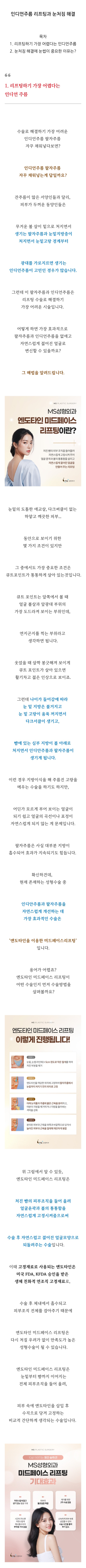 엔도타인성형